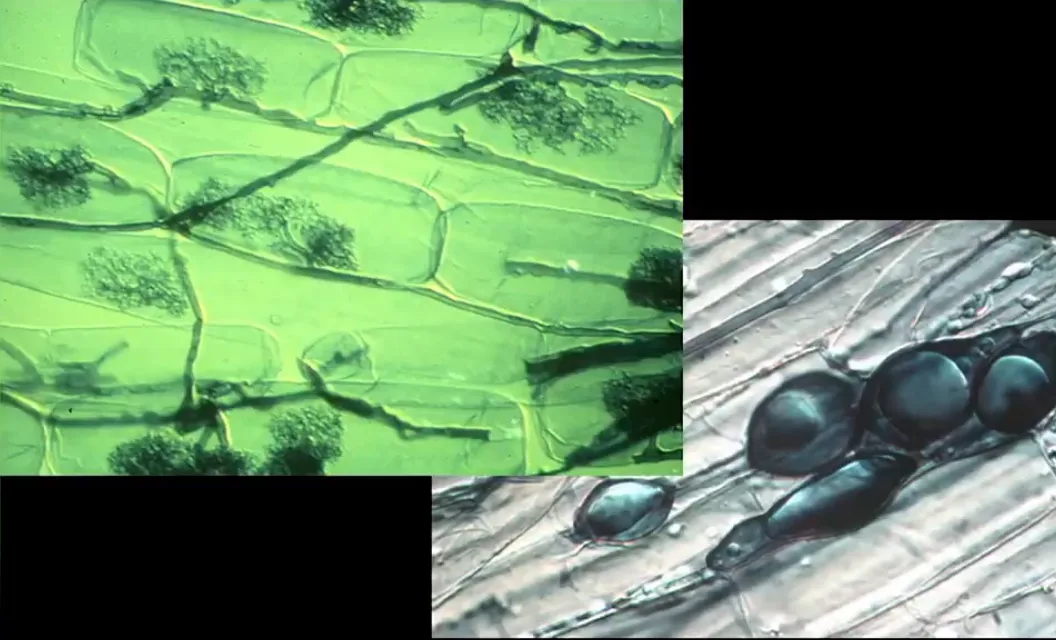 Microfotografía de una micorriza arbuscular en una raíz.