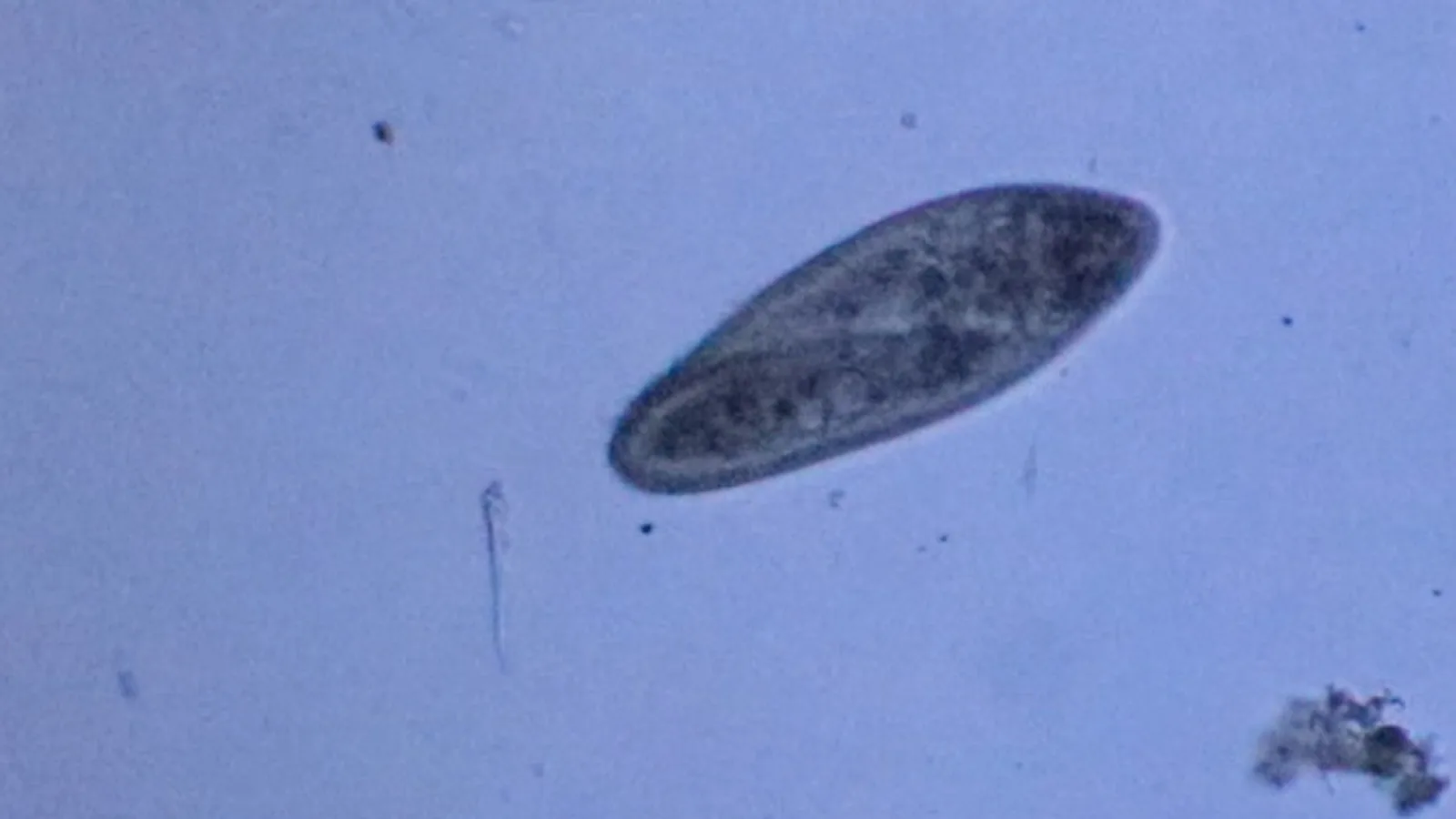 Dokumentarfotografie: Paramecium caudatum