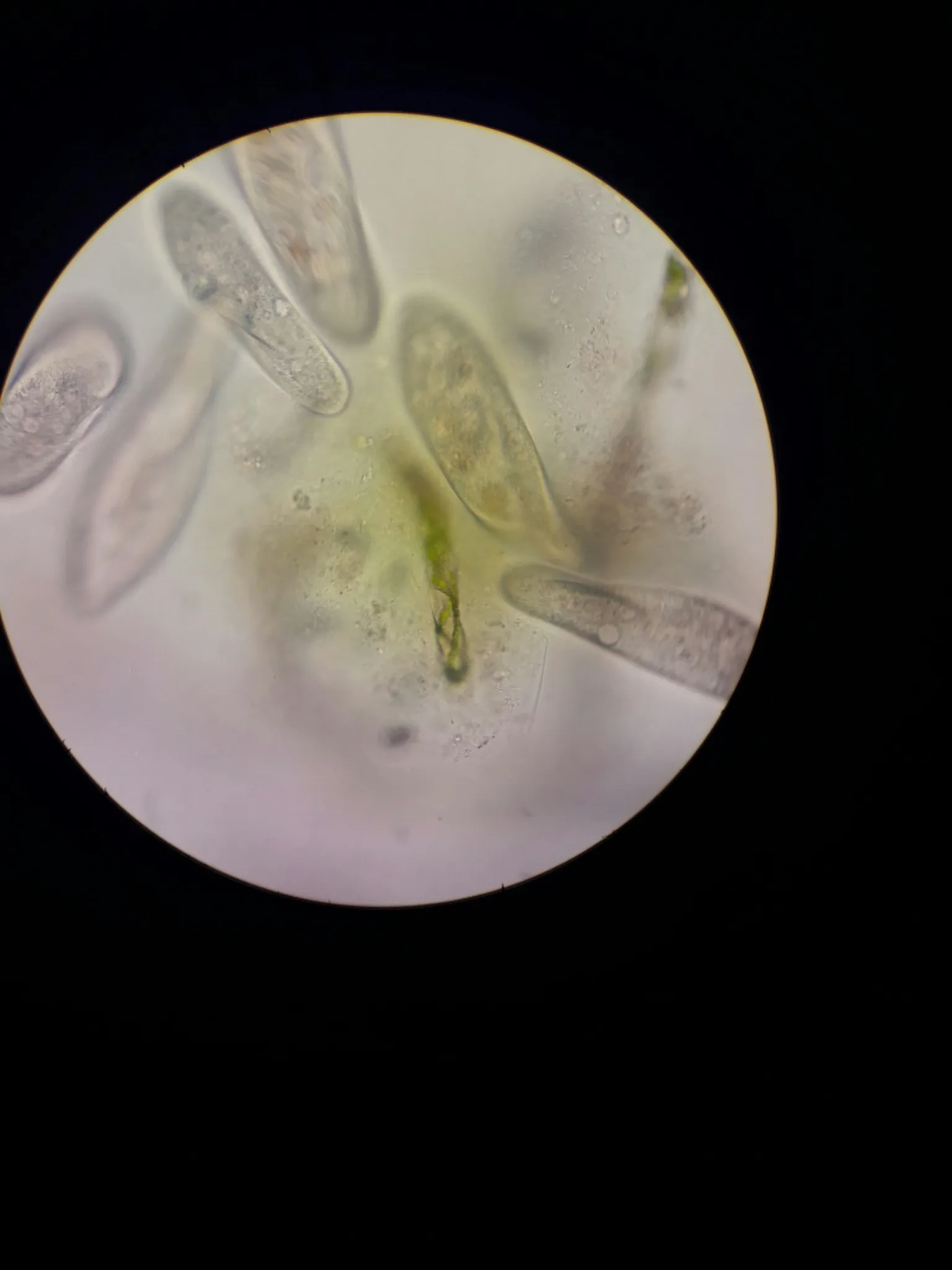 Dokumentarfotografie: Paramecium caudatum